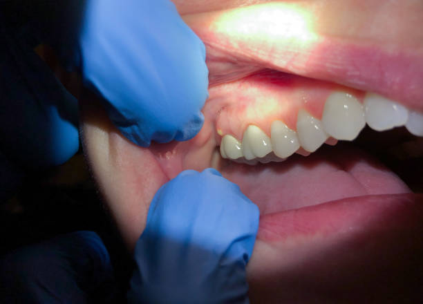 Best 24-Hour Emergency Dentist in South Kensington, MD
